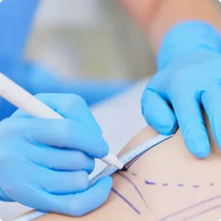 ¿Cómo es el tratamiento para <em>eliminar acné</em>?