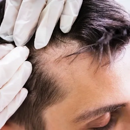 preparación por la intervención