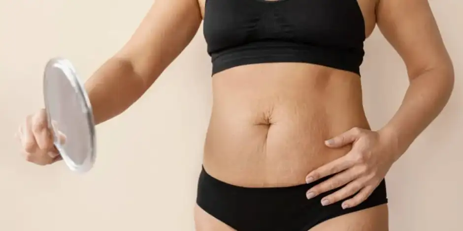 ¿Cómo perder la barriga después del embarazo?