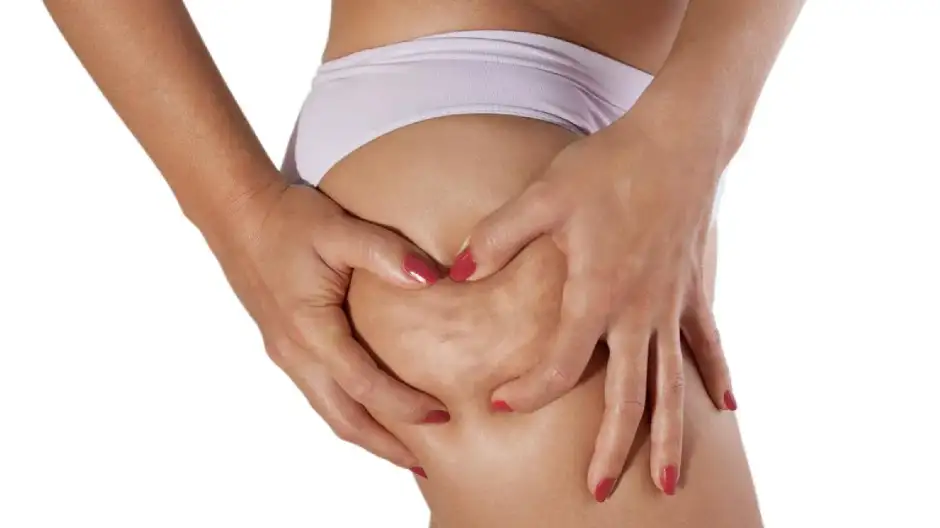 Pre y post tratamiento de <em>flacidez</em>