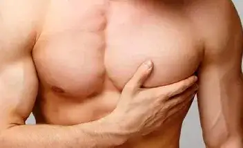 Ginecomastia glandular (extirpación de glándula)