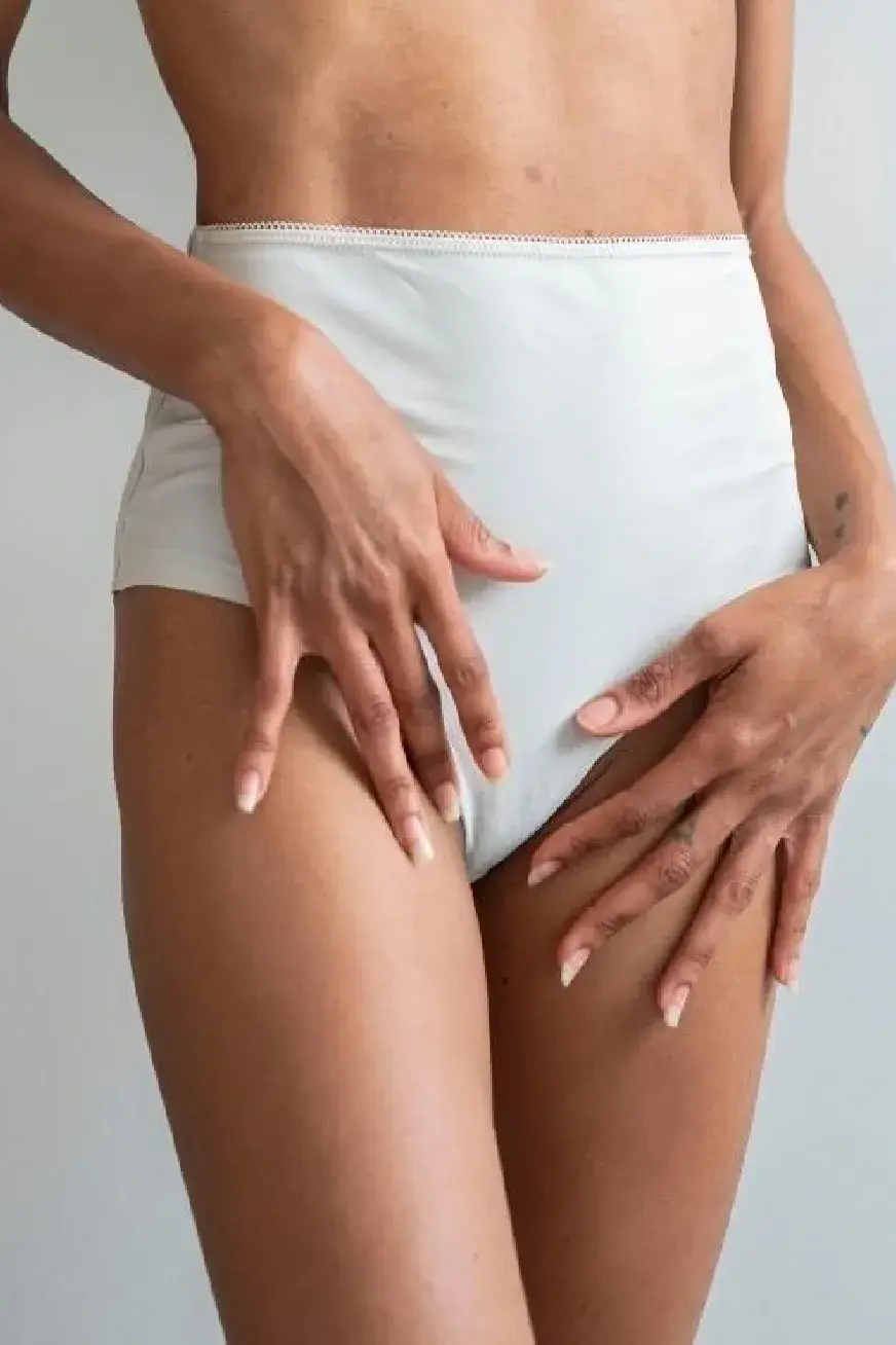 vaginoplastia
