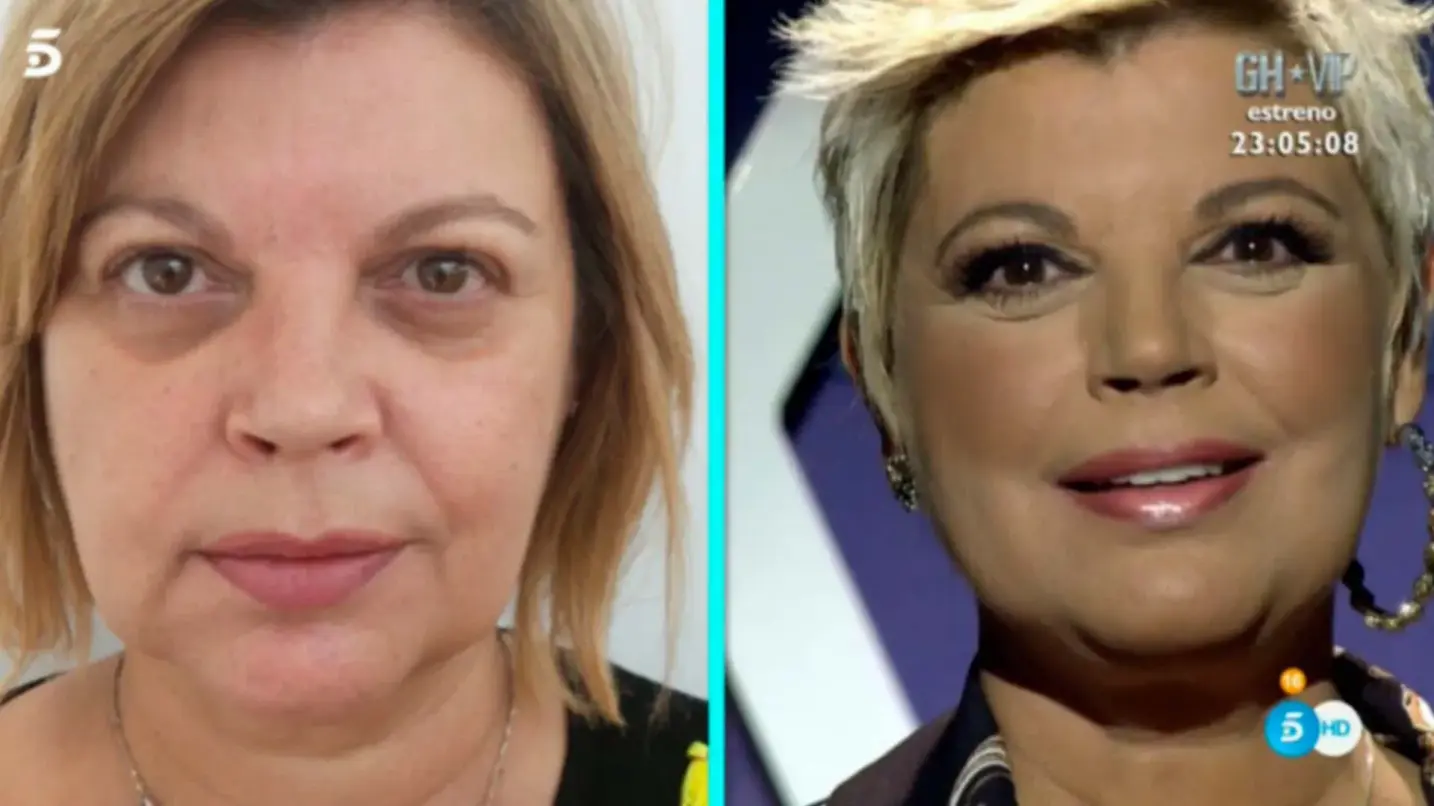 Antes y después de Terelu campos