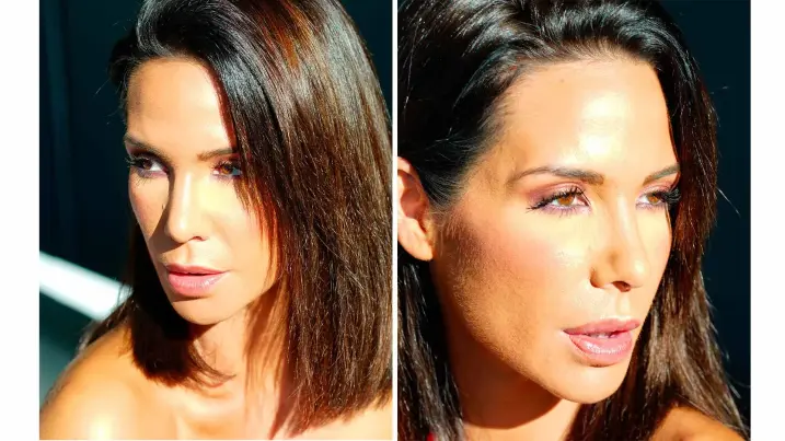 Nariz de Tamara Gorro después de la rinoplastia