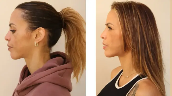Antes y después Paola Olmedo