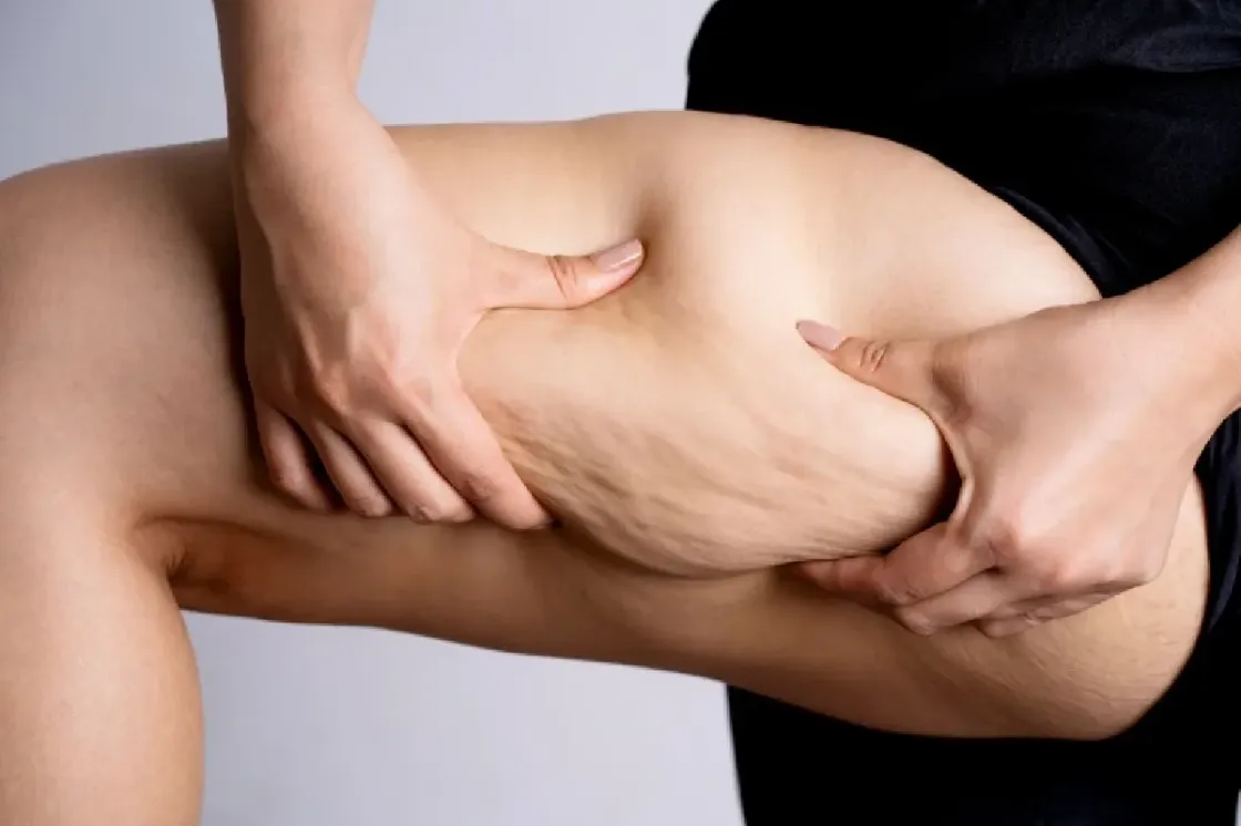 ¿piernas cansadas?