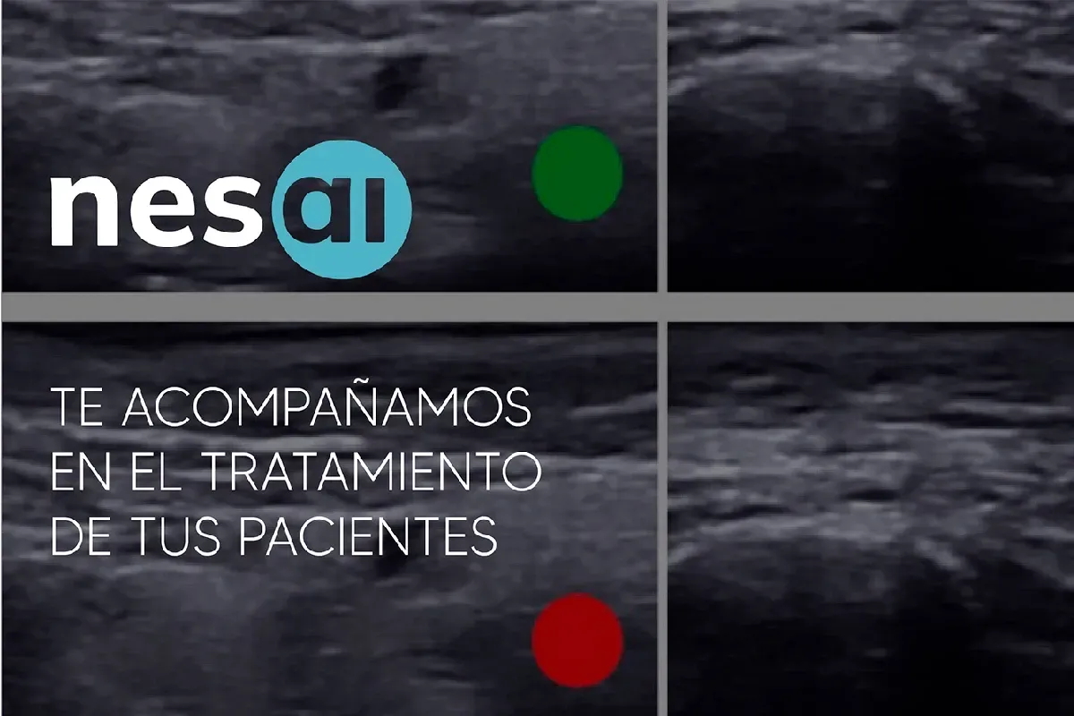 IA diagnostica tratamientos