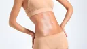 evolución cicatriz abdominoplastia