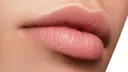 remodelación labial
