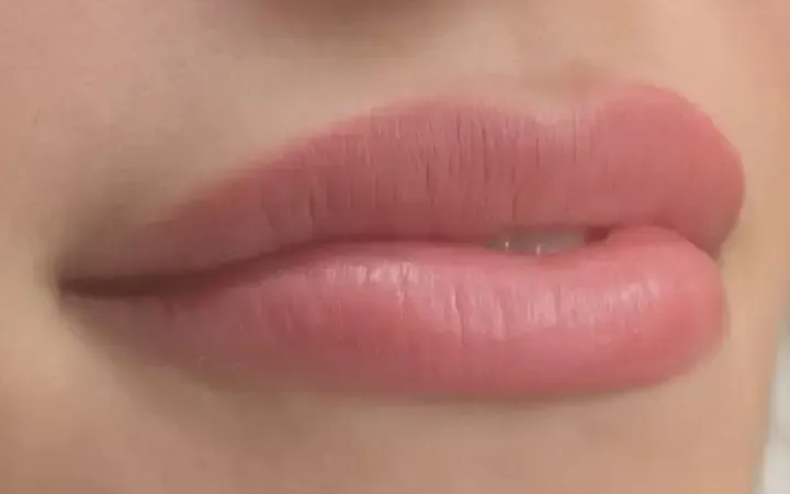 banner labios perfectos