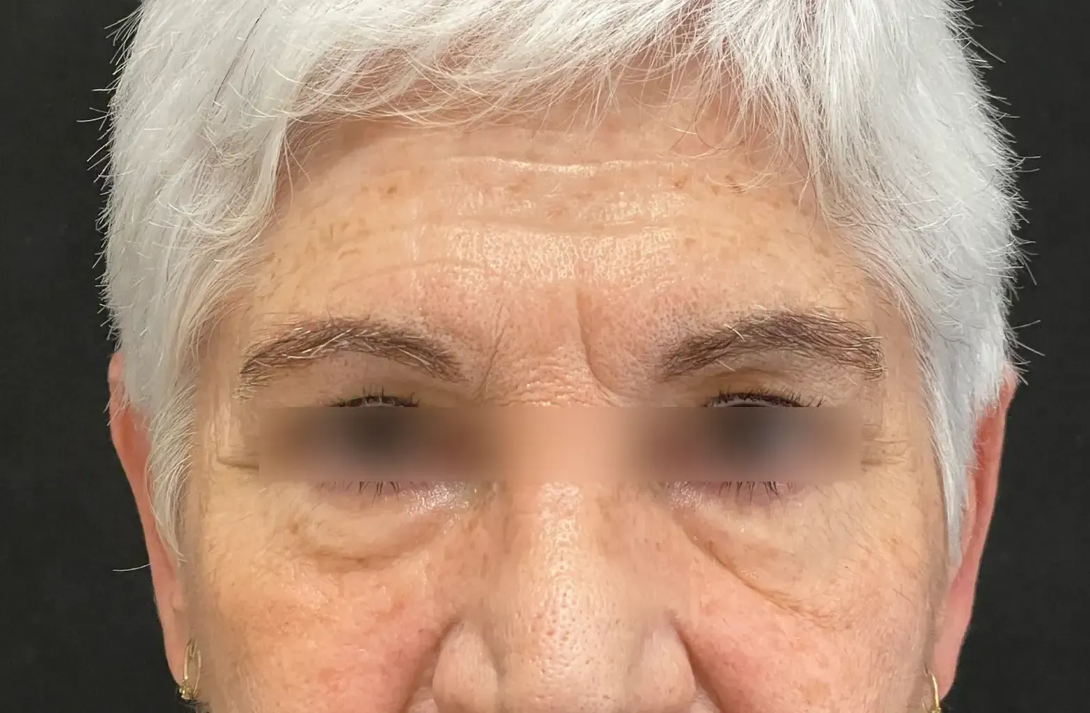 montserrat lifting de cejas antes