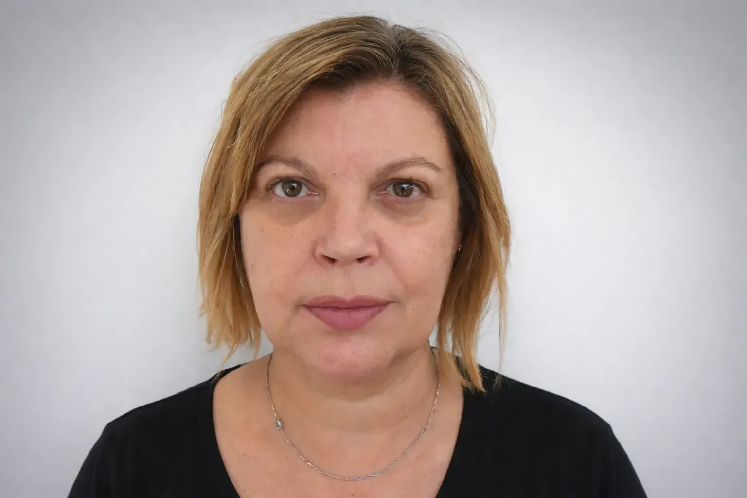 Terelu campos antes de hilos tensores