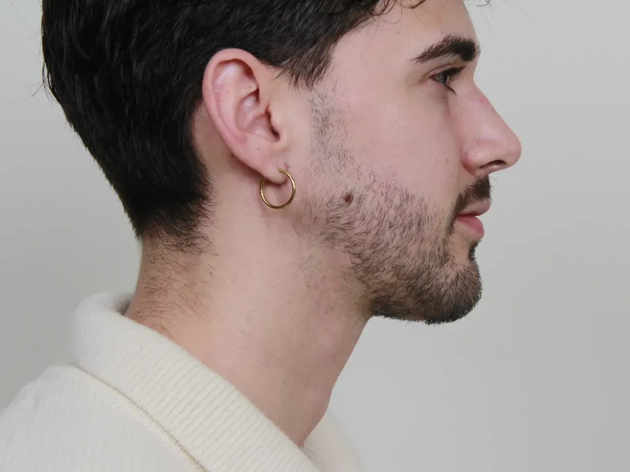 julien despues mentoplastia