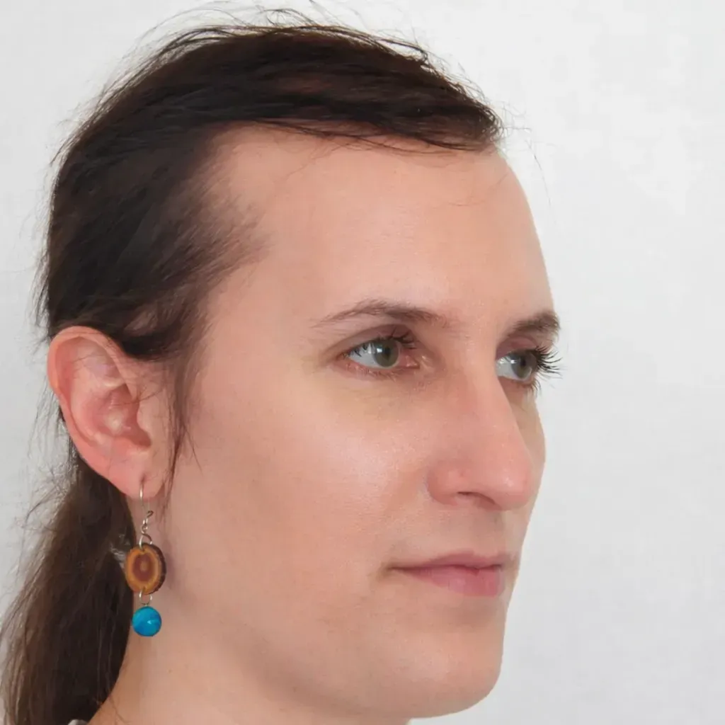 Juan antes de feminización facial