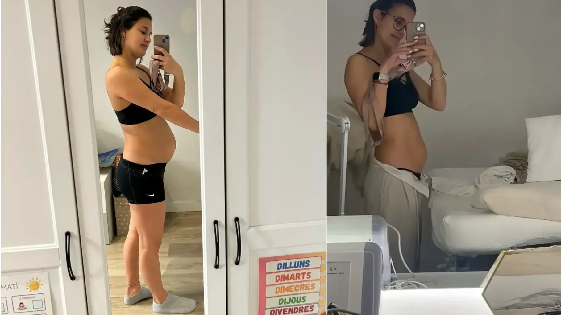 Antes y después de adelgazar con radiofrecia 