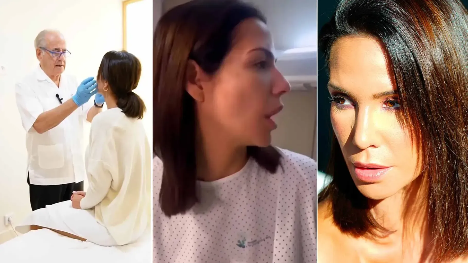 Rinoplastia de Tamara Gorro