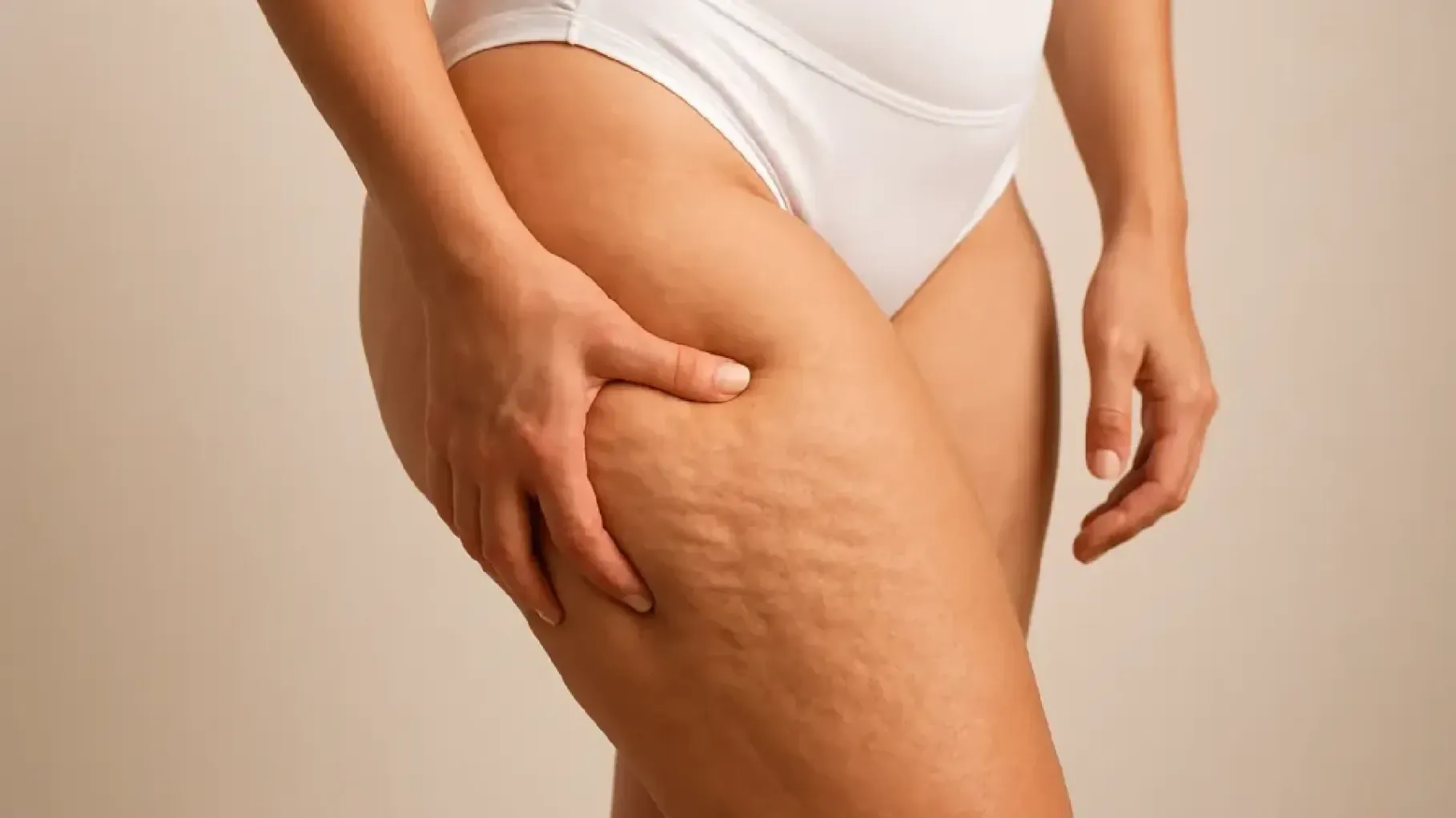 eliminar celulitis