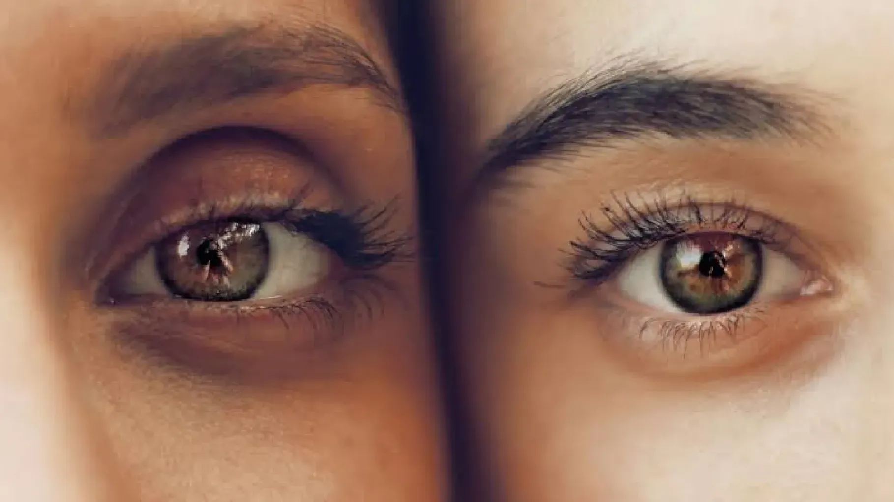 ¿las ojeras se pueden quitar?