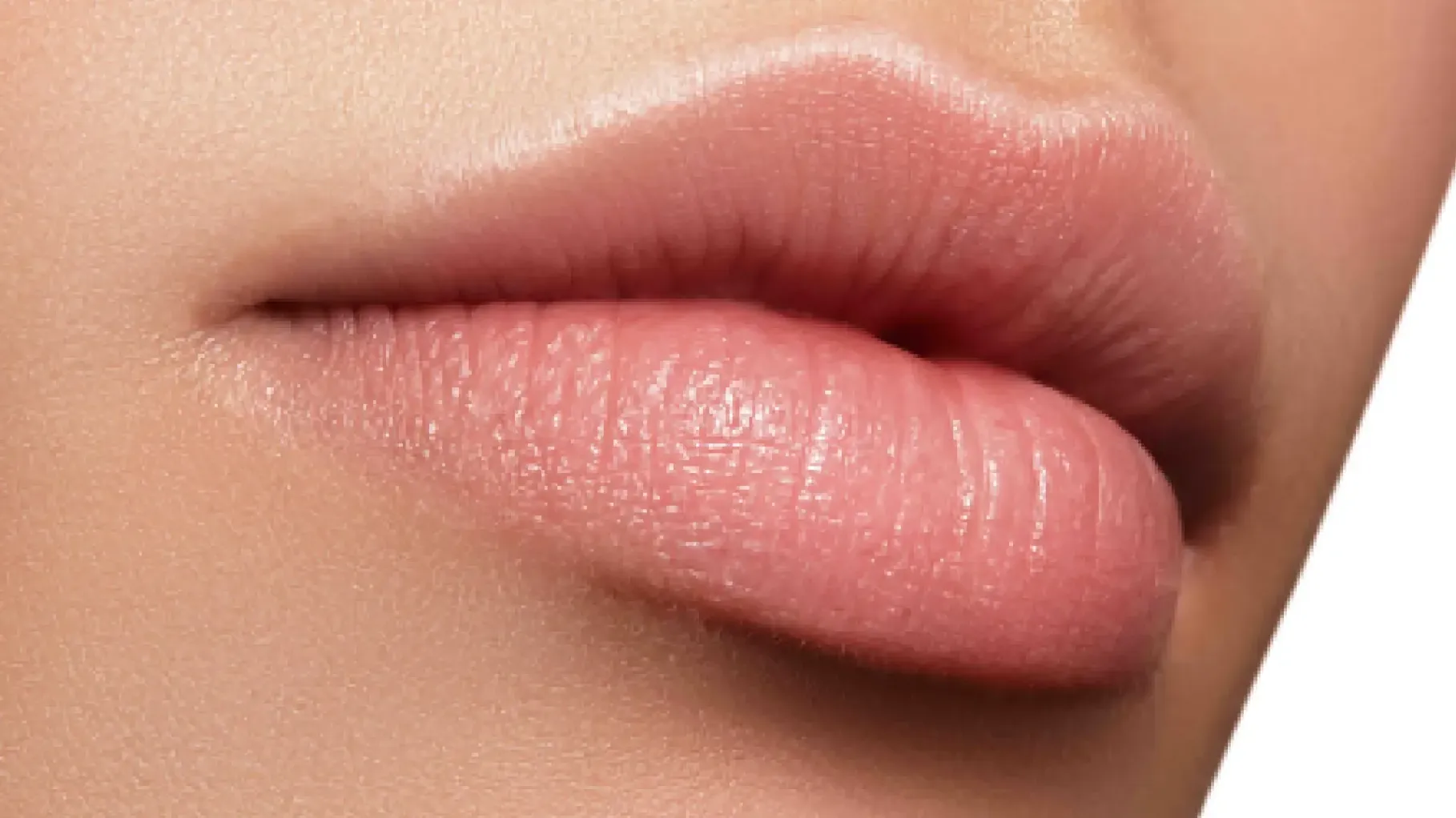 remodelación labial