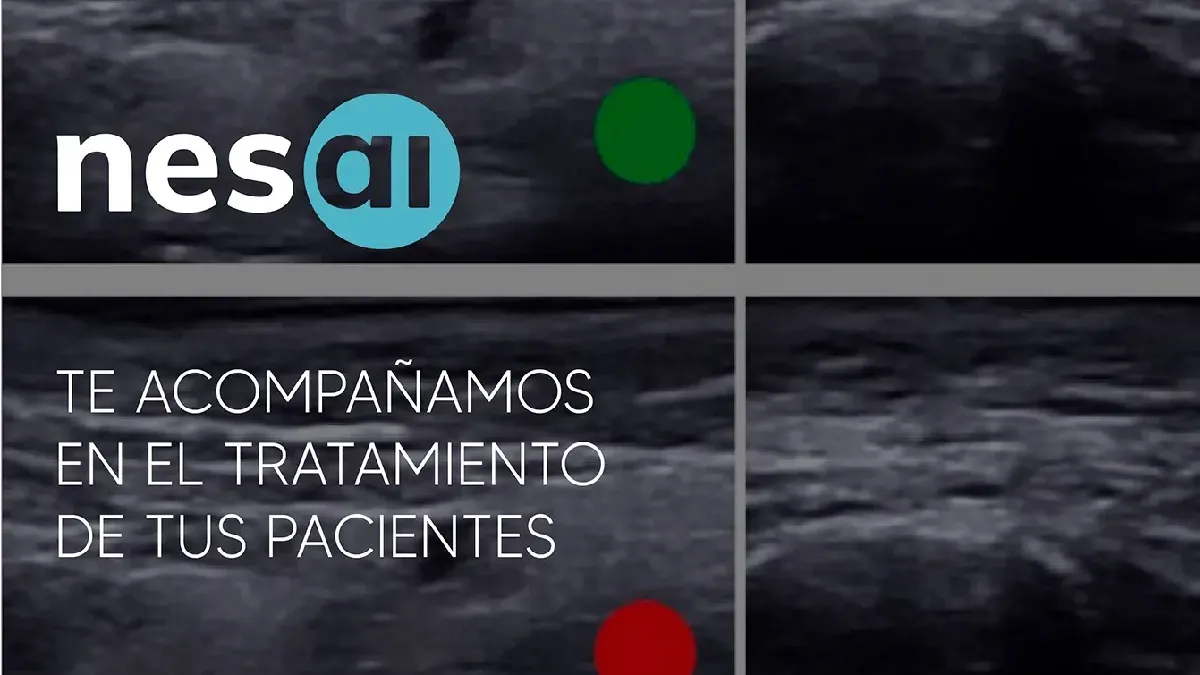 IA diagnostica tratamientos