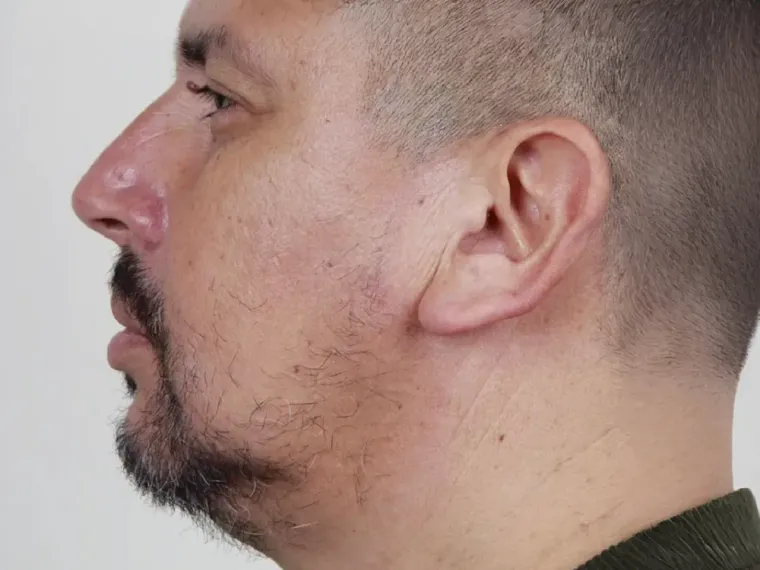 Después