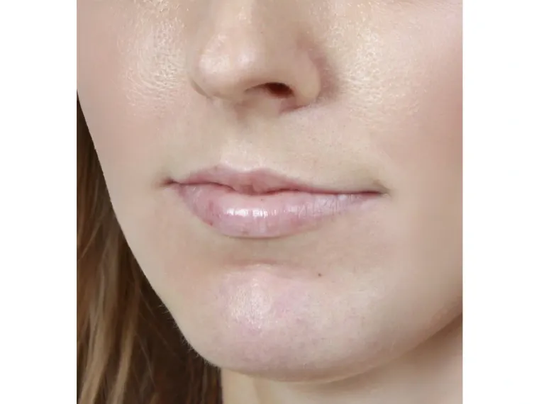 Después