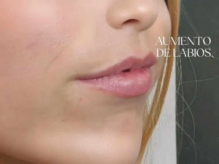 Después