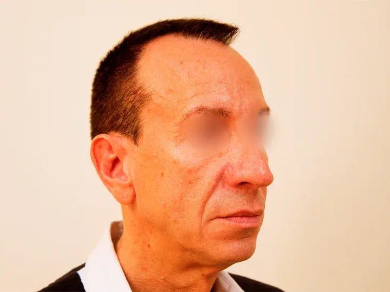 Después