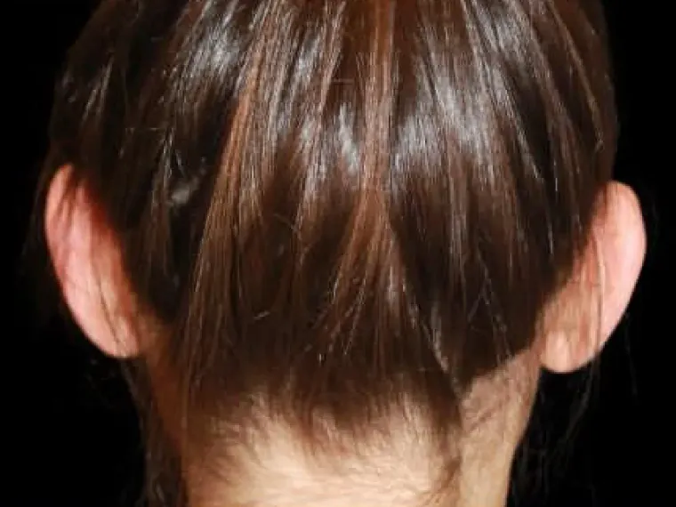 Antes