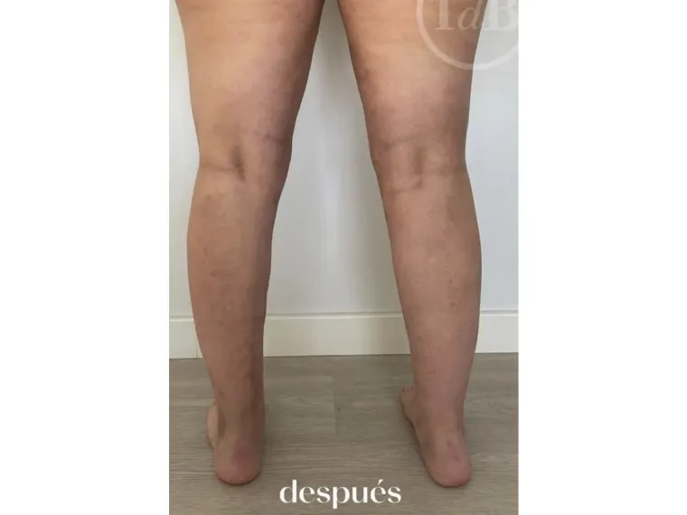 Después