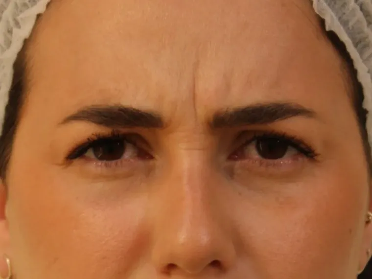 Después