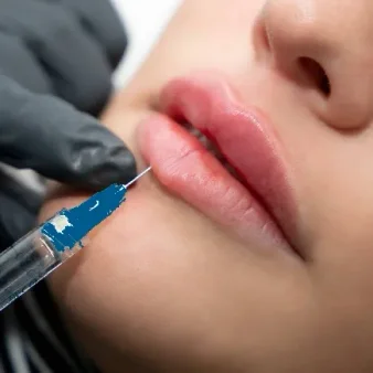 aumento de labios procedimiento