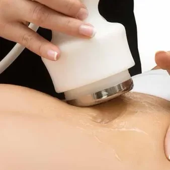 tratamiento body slim