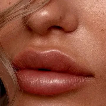 ¿Cómo es el proceso de <em>Aumento de Labios</em>?