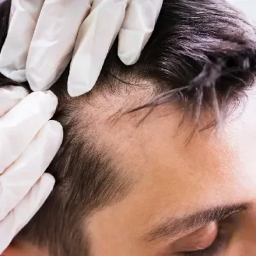 preparación por la intervención