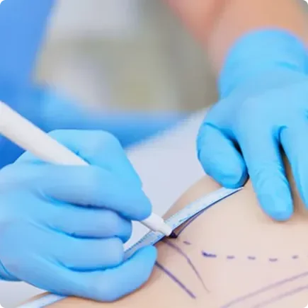 The surgery