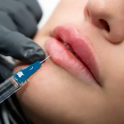 aumento de labios procedimiento