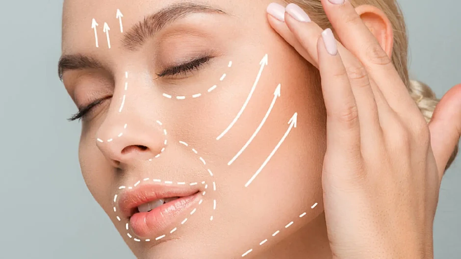 kobido efecto lifting