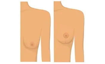 ¿Por que somos el mejor centro de España en Cirugía Estética Mamaria?