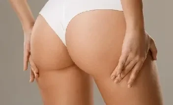 lipotransferencia gluteos estructural