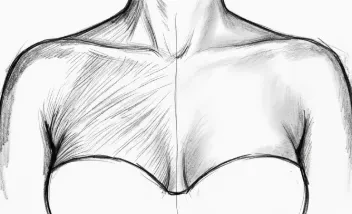  Eliminación del "Efecto Abanico"