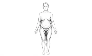 Flacidez moderada de piernas, abdomen y brazos.