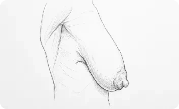 mama Tuberosa Grado 4