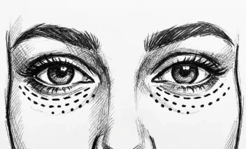 Técnica en plano profundo (supraperióstico)