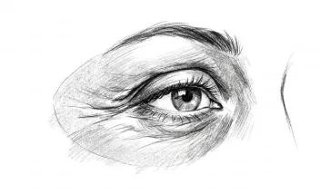 Tratamiento peeling periocular