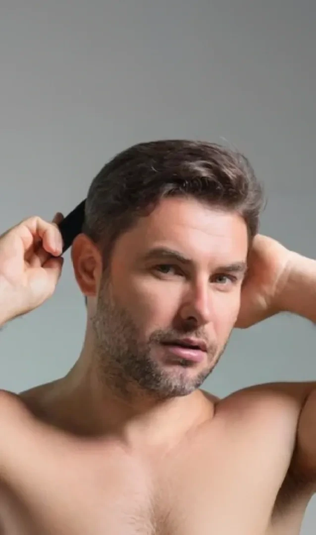 Servicio de mesoterapia capilar