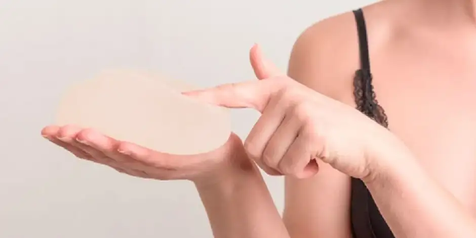 ¿Cada cuanto cambiar implantes de pecho?