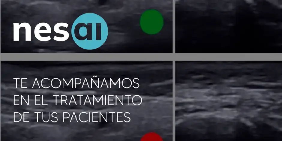 Instituto Benito, pionero en IA para diagnóstico facial