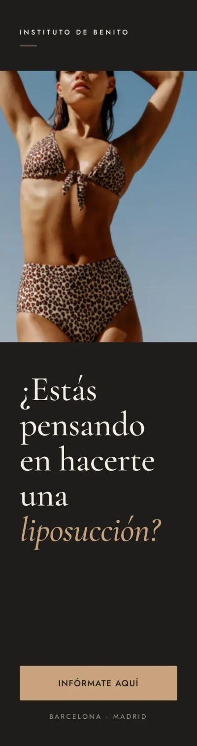 Liposucción en Instituto de Benito: infórmate