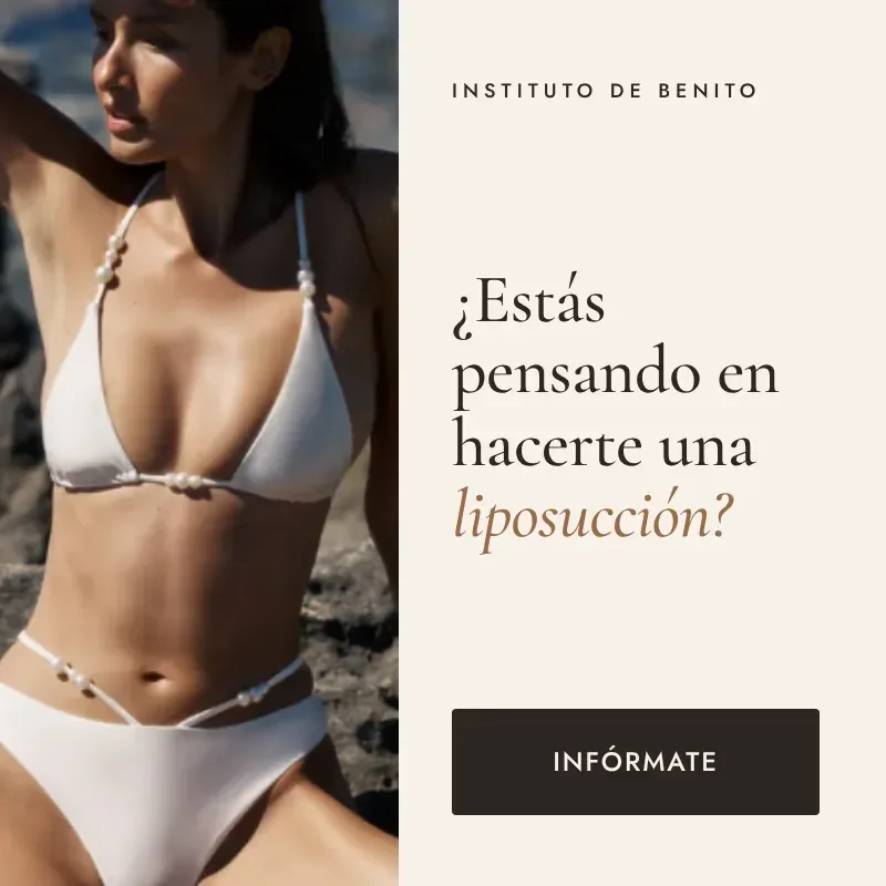 Liposucción en Instituto de Benito: infórmate